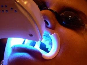 Roselle Teeth Whitening - Dentist