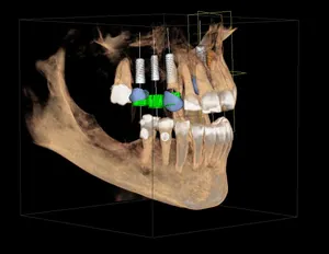 Dental technology.