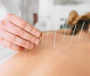 Dr. McDaniel treats patients with acupuncture care