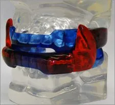 CPAP alternative blue series treatment.