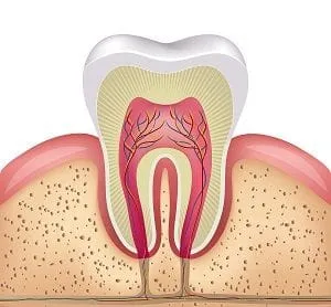 Root Canal Therapy in Moorpark, CA