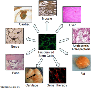 Fat-derived Stem Cells