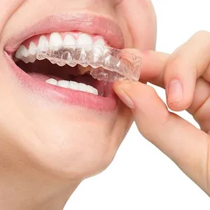 aligners