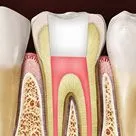 Endodontics