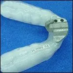 Treat Sleep Apnea and Snoring Without a CPAP