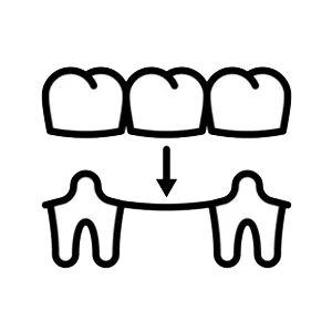 Crowns & Bridgework