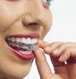 Invisalign Encino CA