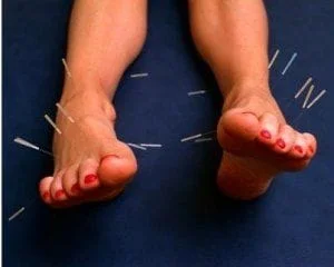 foot_acupuncture.jpg