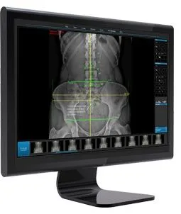 Digital Xrays