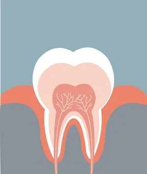 root canals in Zanesville, OH