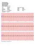 Cardiology Heart Services