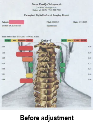 Tytron_Patient_Neck_Pre.jpg