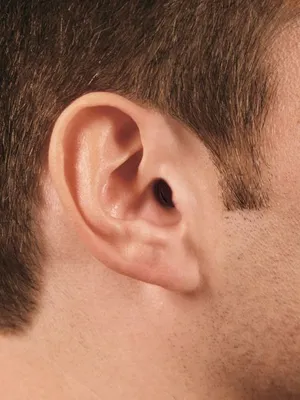 http://www.phonakpro.com/content/dam/phonakpro/gc_us/en/marketing/images/imagecenter/ear/Ear_nano.jpg