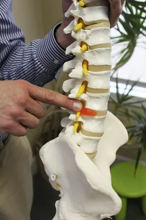 Vertebral Subluxation Chiropractic