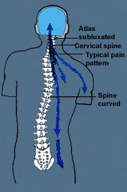 Spine illustratoin