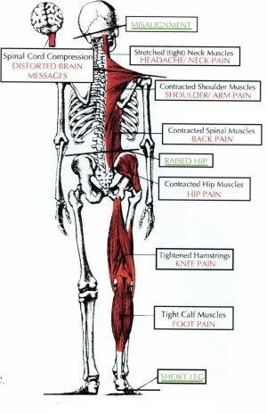 body_imbalance.jpg