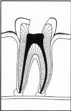 Nerve is removed