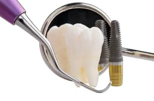 Dental Implant Restorations, Alpharetta