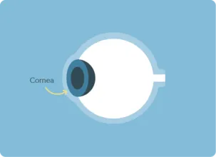 cornea graphic