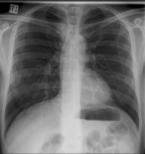 xray300.jpg