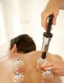 cupping therapy pictures
