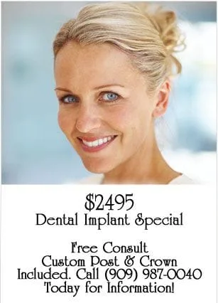 dental implant coupon