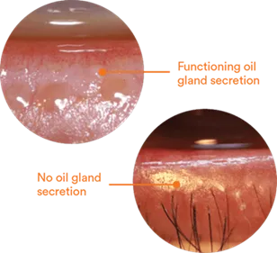 Oil Gland