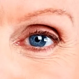 Macular Degeneration