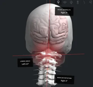diagram of spine