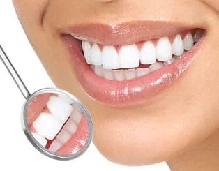  close up of dental mirror and women's mouth smiling bright white teeth, cosmetic dentistry Bradenton, FL dentist