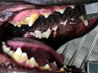 Before dental cleaning