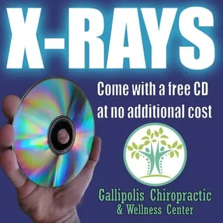 X-Rays come with a FREE CD!