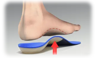 footOverOrthotic_withLine.png
