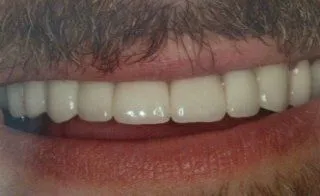 Paul Hanna Dental (formerly Todd S. Larsen, DMD) in Roosevelt UT