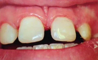 Paul Hanna Dental (formerly Todd S. Larsen, DMD) in Roosevelt UT