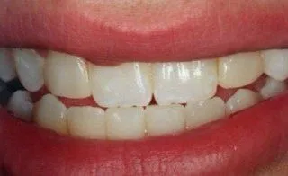 Paul Hanna Dental (formerly Todd S. Larsen, DMD) in Roosevelt UT