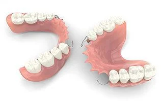 partial dentures with clasp attachments, dentures Kearney, NE dentist