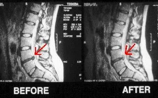 Spine Xray result