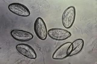 <strong>
</picture>Pinworm Eggs Under a Microscope</strong> <p>These are eggs of the parasite called a "pinworm." The eggs were collected on clear tape applied to the area around the anus.</p>