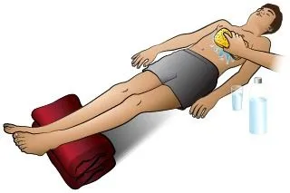 <strong>
</picture>First Aid - Heat Exhaustion</strong> <ul><li>Move the victim to a cool shady area. If possible, move into an air-conditioned place.</li><li>The victim should lie down. Elevate the feet.</li><li>Undress victim (except for underwear) so the body surface can give off heat. </li><li>Sponge the entire body surface continuously with cool water. Fan the victim to increase evaporation.</li><li>Give as much cold water or sports drink (e.g., Gatorade, Powerade) as the victim can tolerate. An adult or teen with heat exhaustion should drink 2-3 cups (480-720 ml) of liquids right away to replace what was lost. Then the adult or teen should drink approximately 1 cup (240 ml) every 15 minutes for the next 1-2 hours.</li></ul>