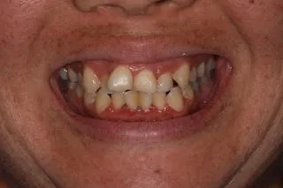 accelerated treatment honolulu hi