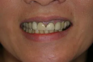 accelerated treatment honolulu