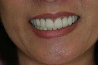 honolulu accelerated treatment