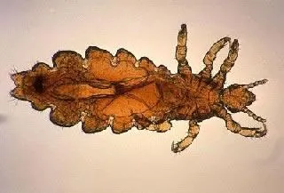 <strong>
</picture>Head Louse</strong>