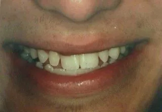 Paul Hanna Dental (formerly Todd S. Larsen, DMD) in Roosevelt UT