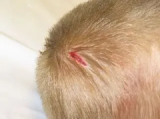 <strong>
</picture>Laceration - Scalp</strong> <p>This scalp laceration (cut) is gaping open. It will require closure with sutures or medical staples. </p><p>First Aid Care Advice:</p><ul><li>Apply direct pressure for 10 minutes to stop any bleeding.</li><li>Wash the cut with soap and water.</li></ul>