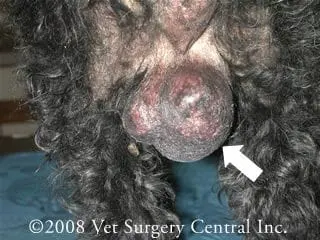testicular tumor