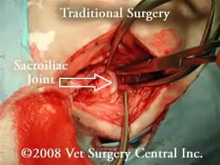 Traditional Surgery