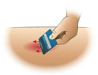 <strong>
</picture>First Aid - Removing a Stinger</strong> <p>The stinger looks like a tiny black dot in the center of the sting. There are many different methods of removal. Removing the stinger quickly is more important than the method of removal used.</p><ul><li>You can scrape it out with a credit card or finger nail.</li><li>You can also use adhesive tape.</li><li>If only a small fragment remains, don't worry about it. It will shed with the skin.</li></ul><p>Special Notes: </p><ul><li>In many cases no stinger will be present. </li><li>Only bees leave their stingers. Wasps, yellow jackets and hornets do not.</li></ul>