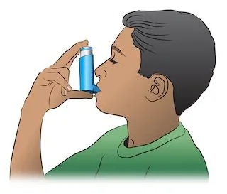 <strong>
</picture>How to Use a MDI</strong> <p>A <strong>metered dose inhaler (MDI)</strong> is a device used to deliver asthma medicine into the lungs. To  be sure to deliver the medicine effectively, use the following steps:</p><ul><li>STEP 1 - Remove the cap and shake the inhaler.</li><li>STEP 2 - Hold the inhaler about 1-2 inches in front of the mouth. Breathe out - completely.</li><li>STEP 3 - Press down on the inhaler to release the medicine as you start to breathe in slowly.</li><li>STEP 4 - Breathe in slowly for three to five seconds.</li><li>STEP 5 - Hold your breath for ten seconds to allow the medicine to reach deeply into your lungs.</li><li>If your doctor has prescribed two puffs, wait 1 minute and then repeat steps 2-5.</li></ul>